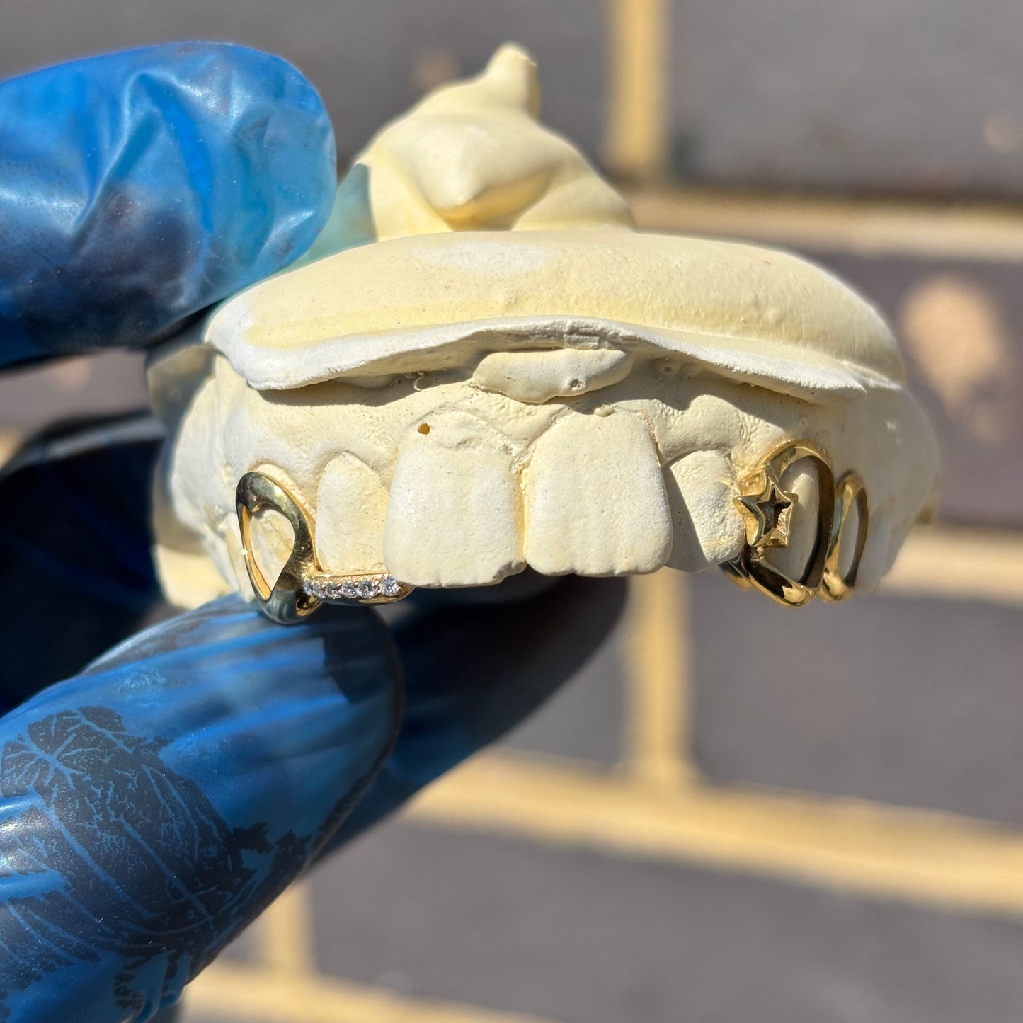 Custom Yellow Gold Grillz