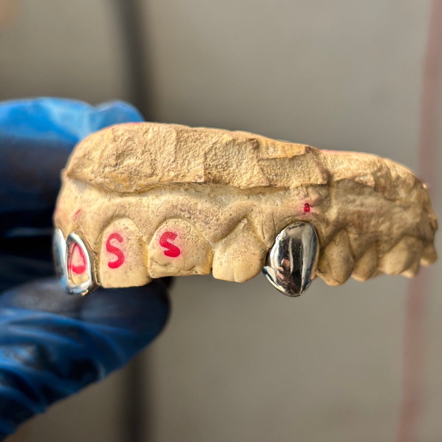 Custom 925 Sterling Silver Grillz