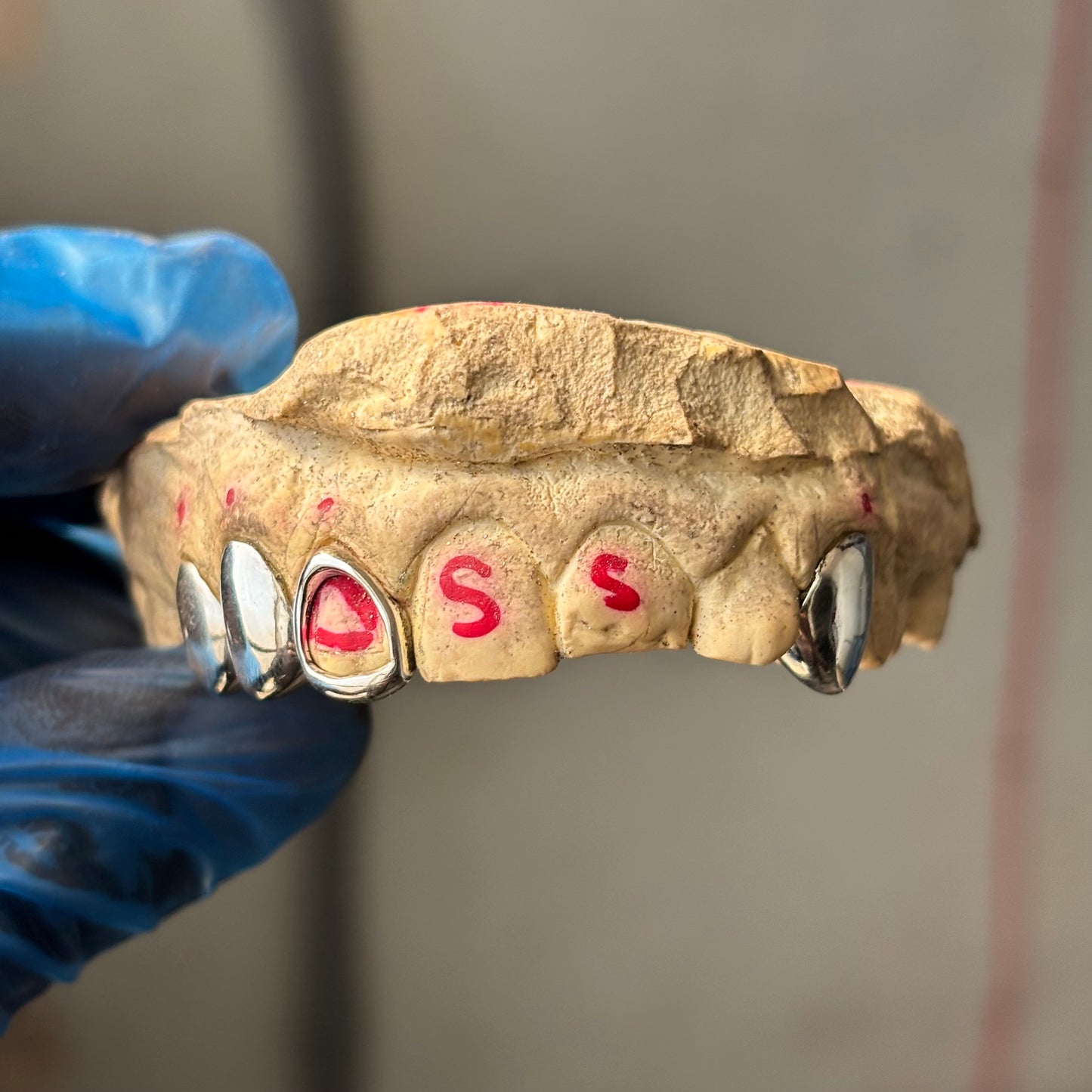 Custom 925 Sterling Silver Grillz