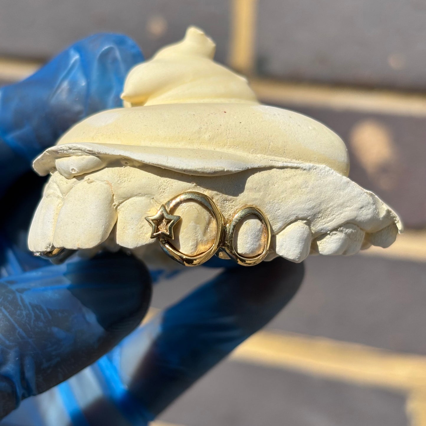 Custom Yellow Gold Grillz