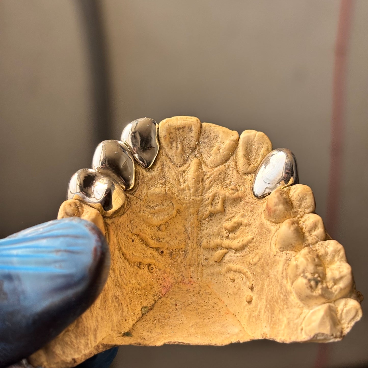 Custom 925 Sterling Silver Grillz