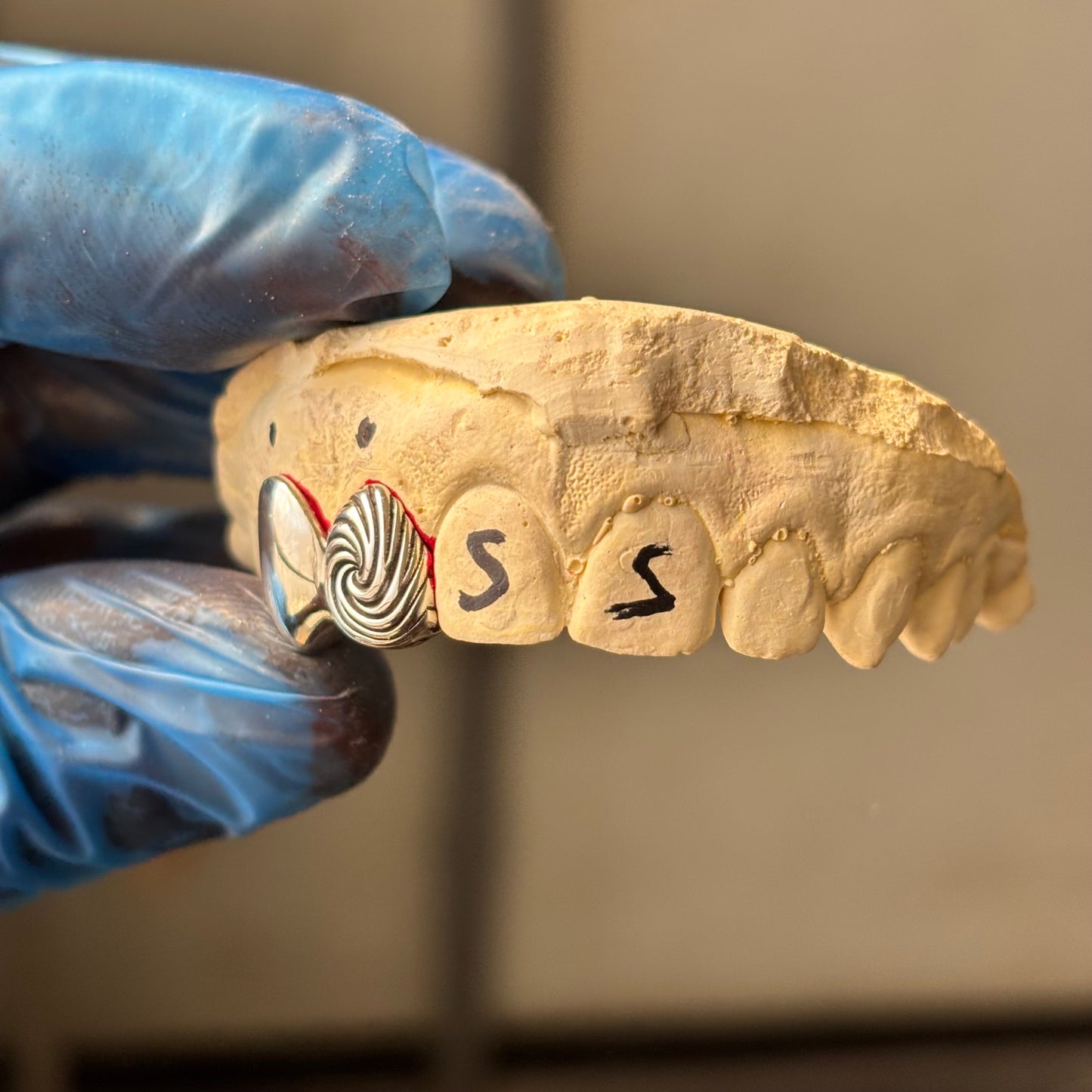 Spiral 925 Sterling Silver Grillz
