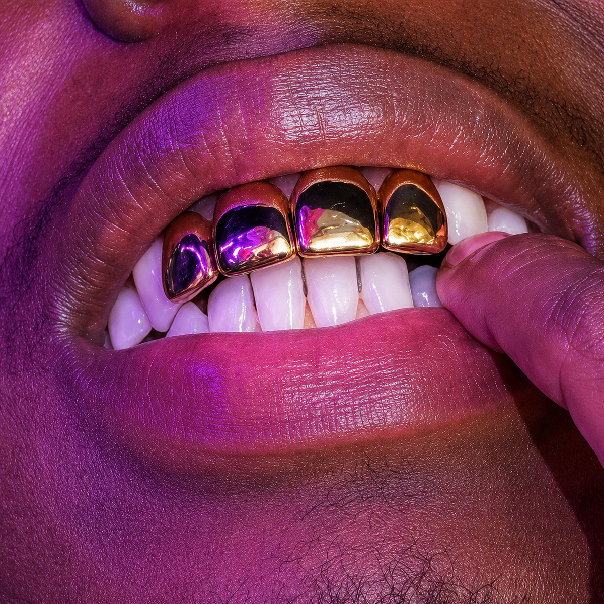 4 Gold Teeth
