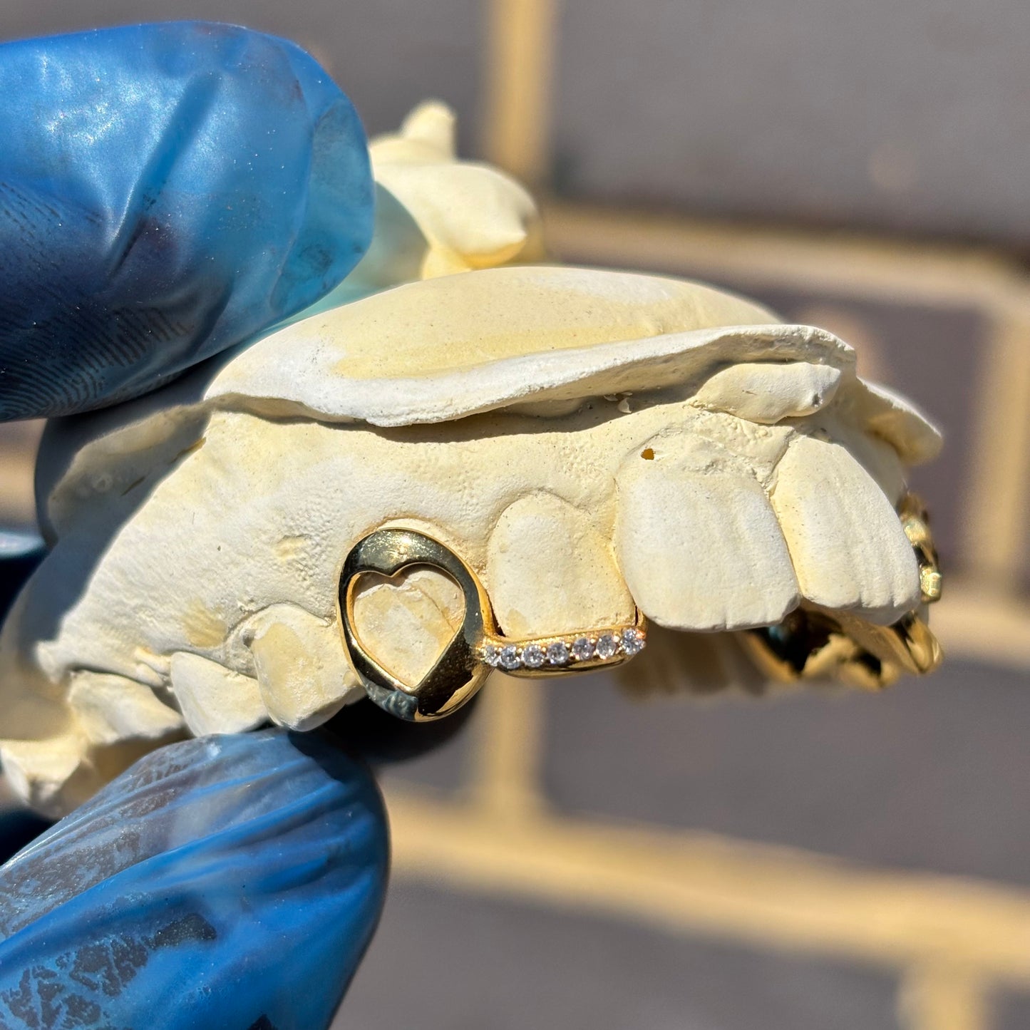 Custom Yellow Gold Grillz