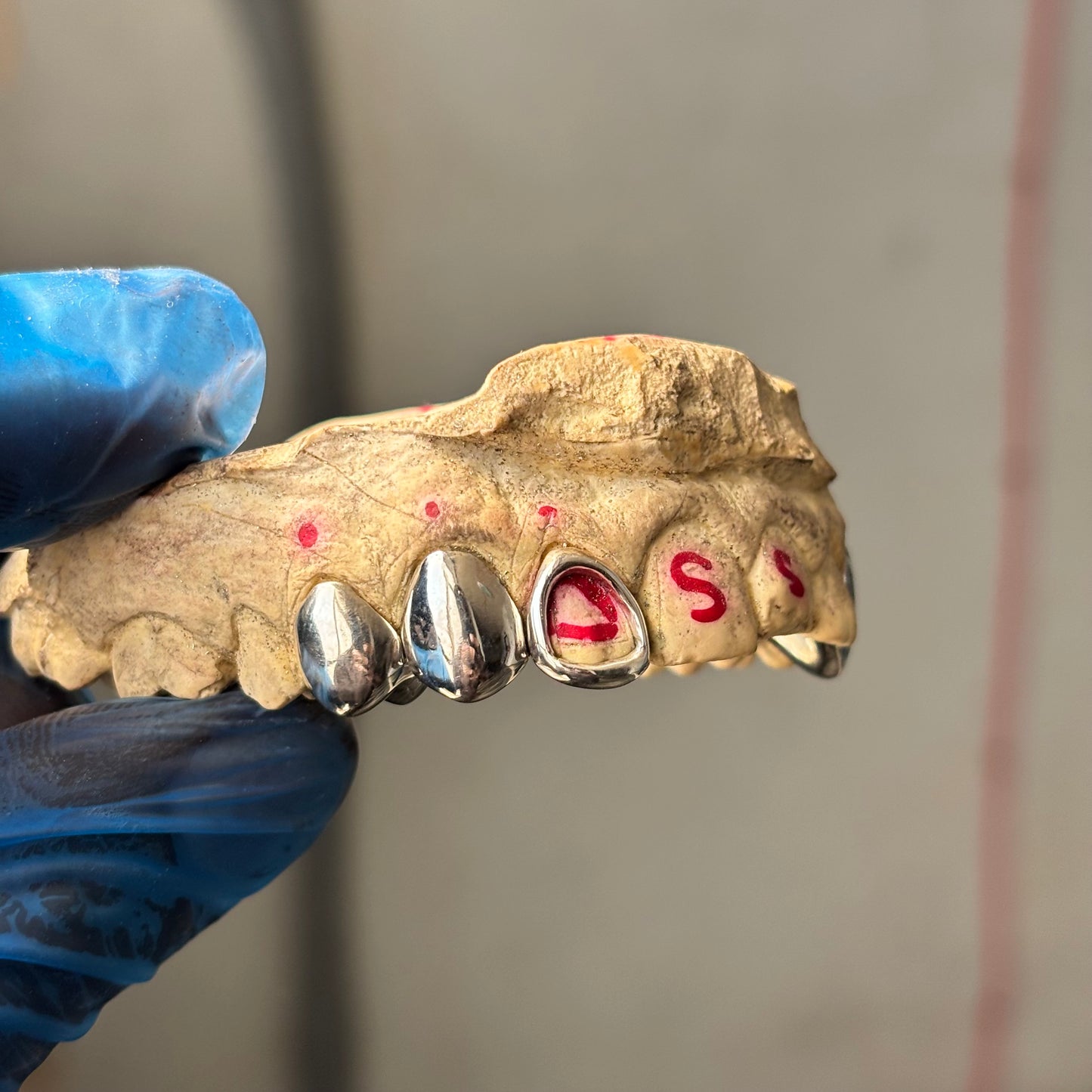 Custom 925 Sterling Silver Grillz
