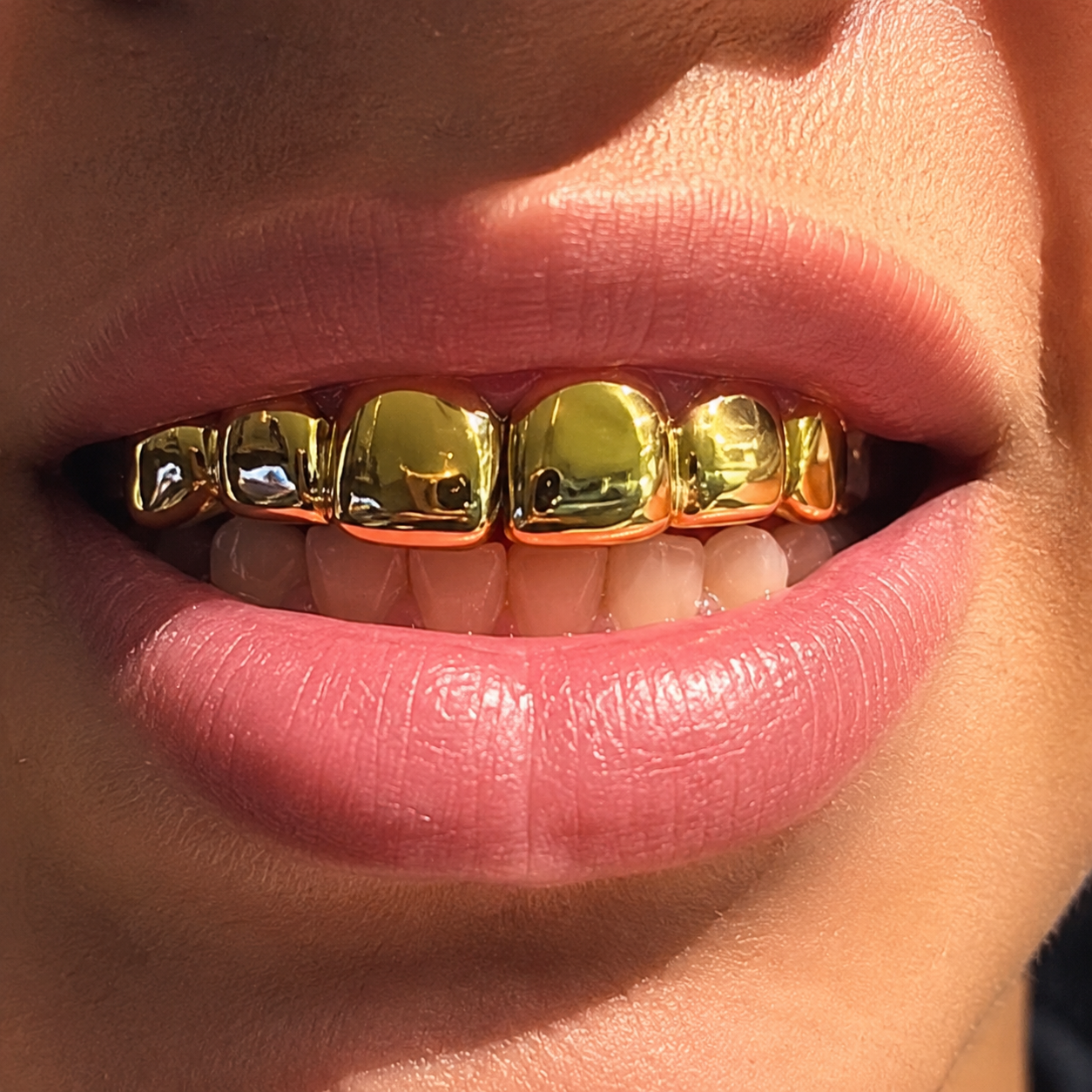 6 Gold Teeth