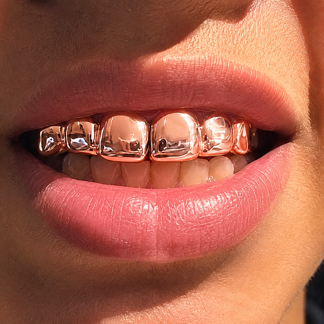 6 Gold Teeth