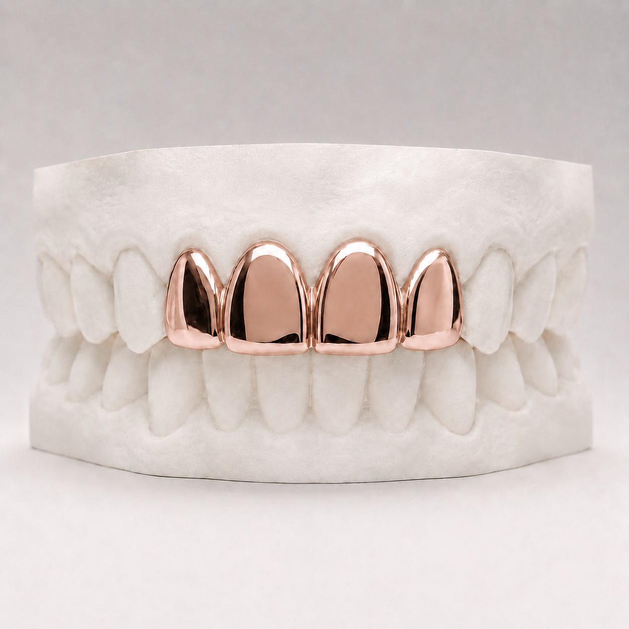 4 Gold Teeth